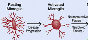 microglia-resting-activated
