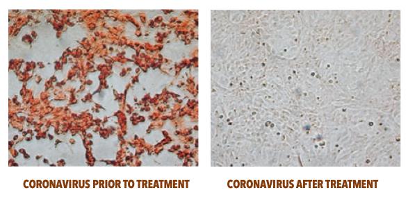 COmparison: Coronavirus prior and after treatment