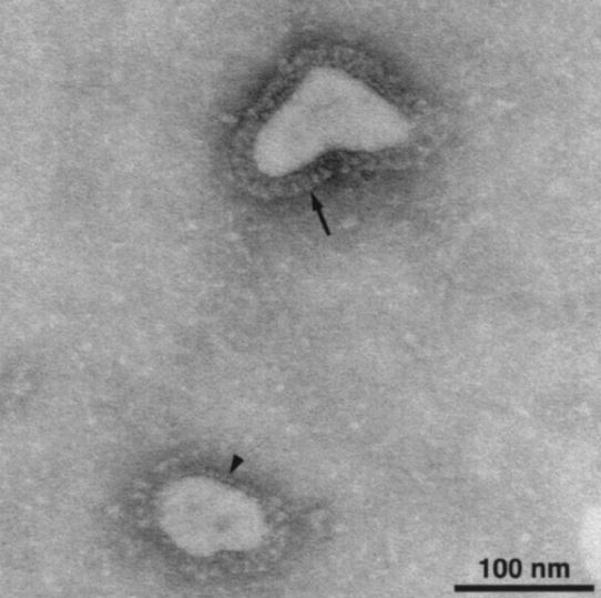 Electron micrograph image of coronavirus