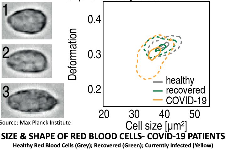 Covid-19 red blood cells
