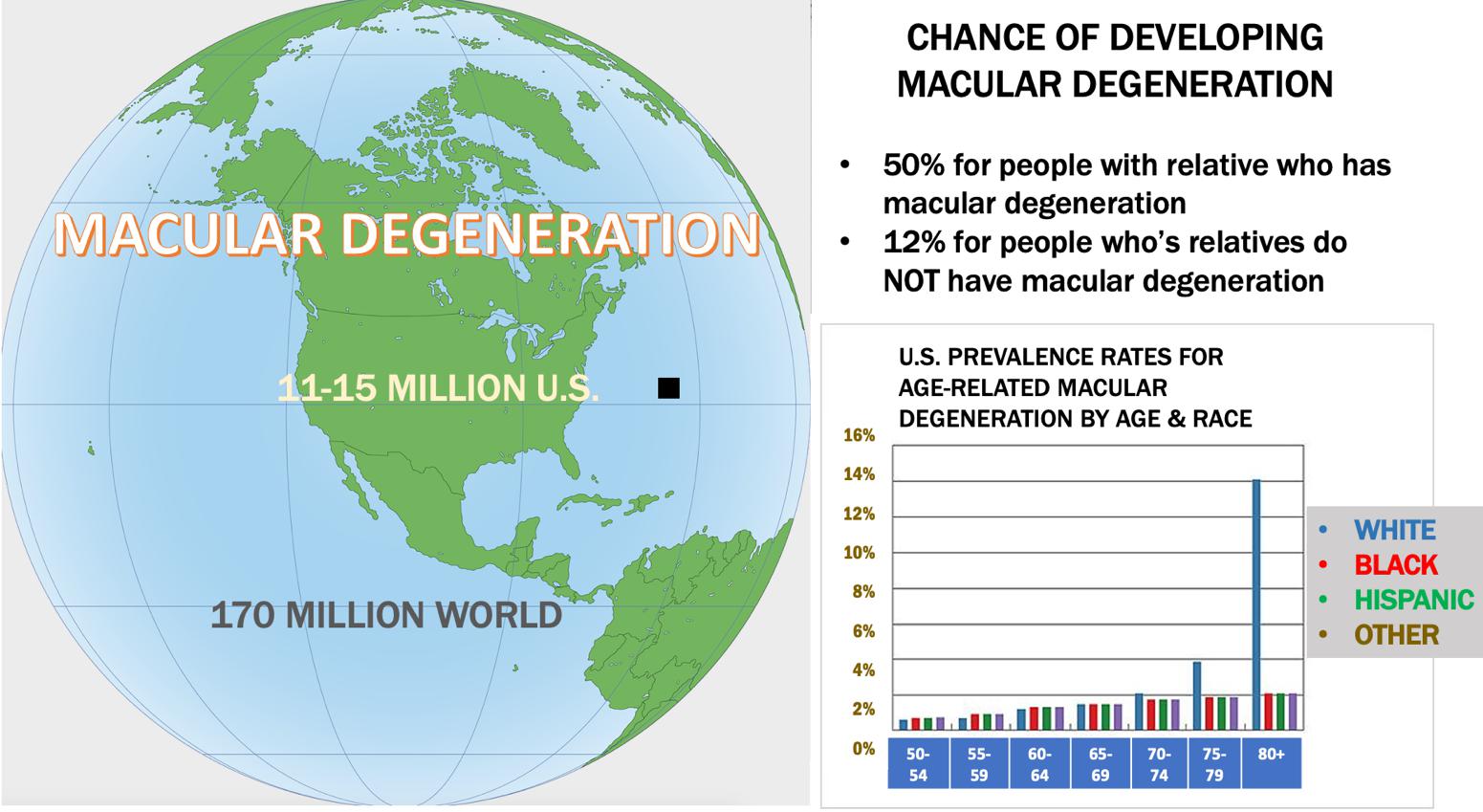 Chart: chances of developing Macular Degeneration